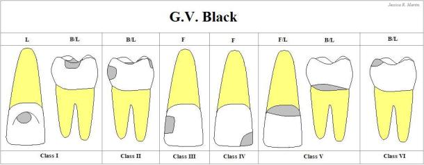 GV-BLACK-1