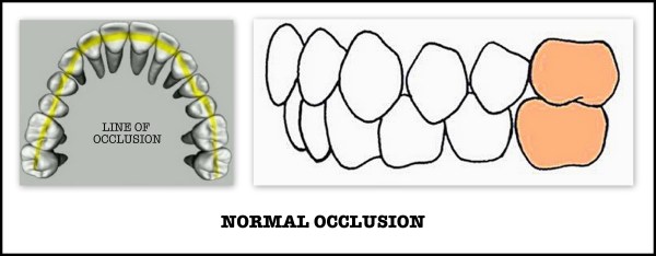 NORMAL OCCLUSION