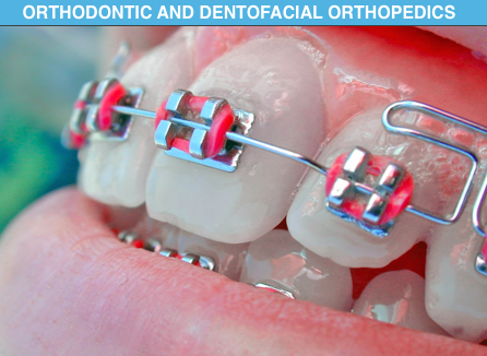 Orthodontics