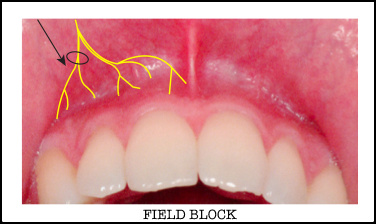 Screen Shot 2014-12-08 at 3.03.46 PM.png