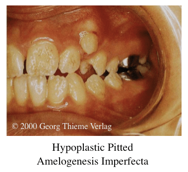 Screen Shot 2015-01-12 at 1.19.28 AM