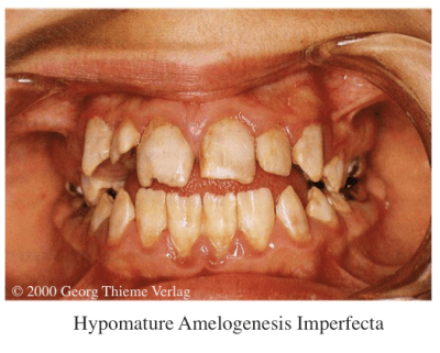 Screen Shot 2015-01-12 at 1.28.28 AM