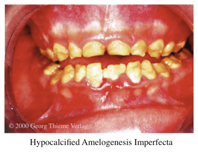 Screen Shot 2015-01-12 at 1.36.06 AM