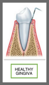 HEALTHY GINGIVA